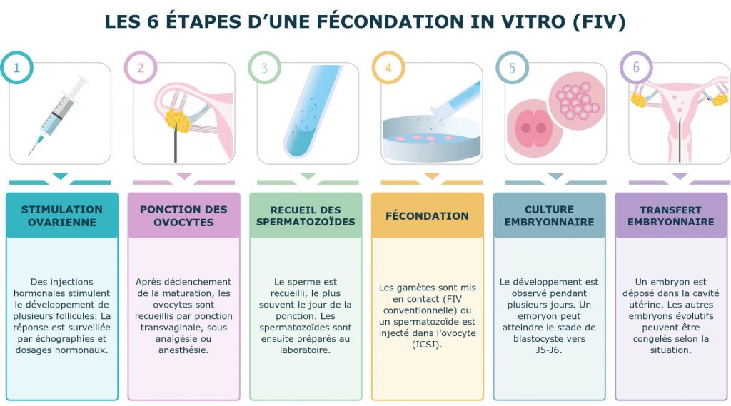 Infographie des six étapes d’une fécondation in vitro, de la stimulation ovarienne au transfert embryonnaire