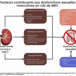 Facteurs DSM MRC