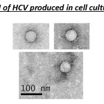 Microscopies électroniques du virus de l’hépatite C