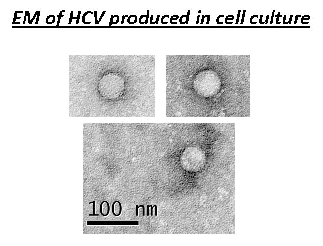 Microscopies électroniques du virus de l’hépatite C