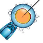 Illustration ICSI : injection d'un spermatozoïde dans un ovocyte